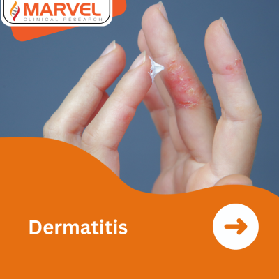 Atopic Dermatitis